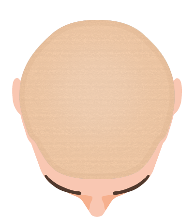 Full Lace System Full Lace System