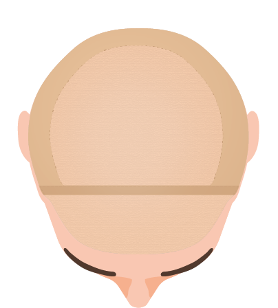 Half Lace System Half Lace System